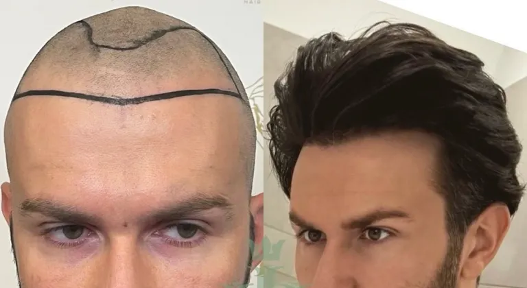 Hair of Istanbul